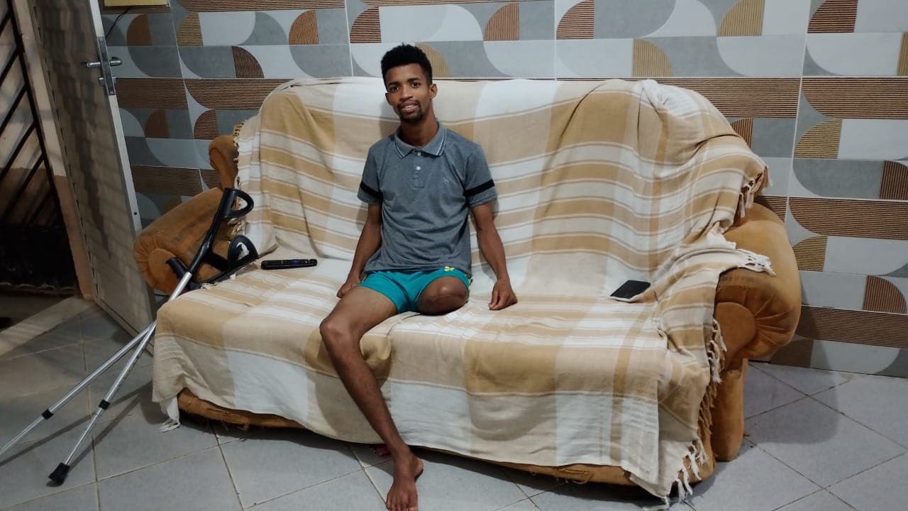 Mateus Araújo, 21 anos, amputou perna após ser alvejado pela PM em Dias d´Ávila, Bahia