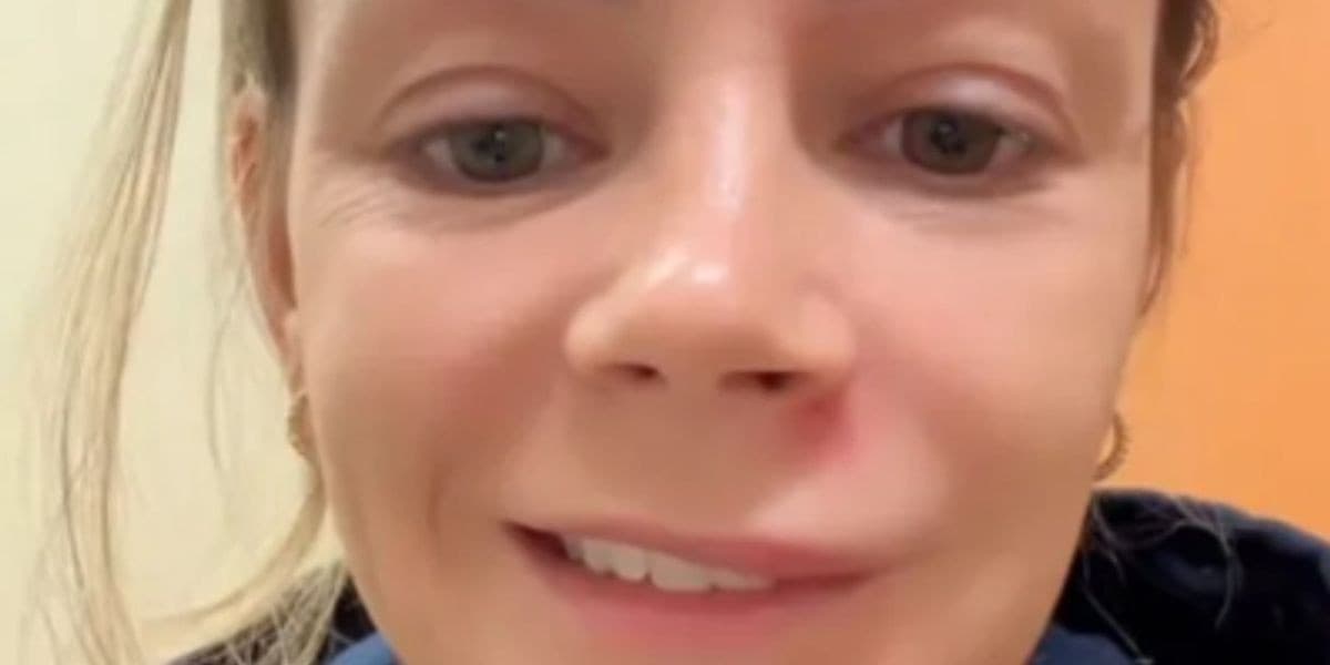 Influenciadora alerta após espremer espinha e parar no hospital