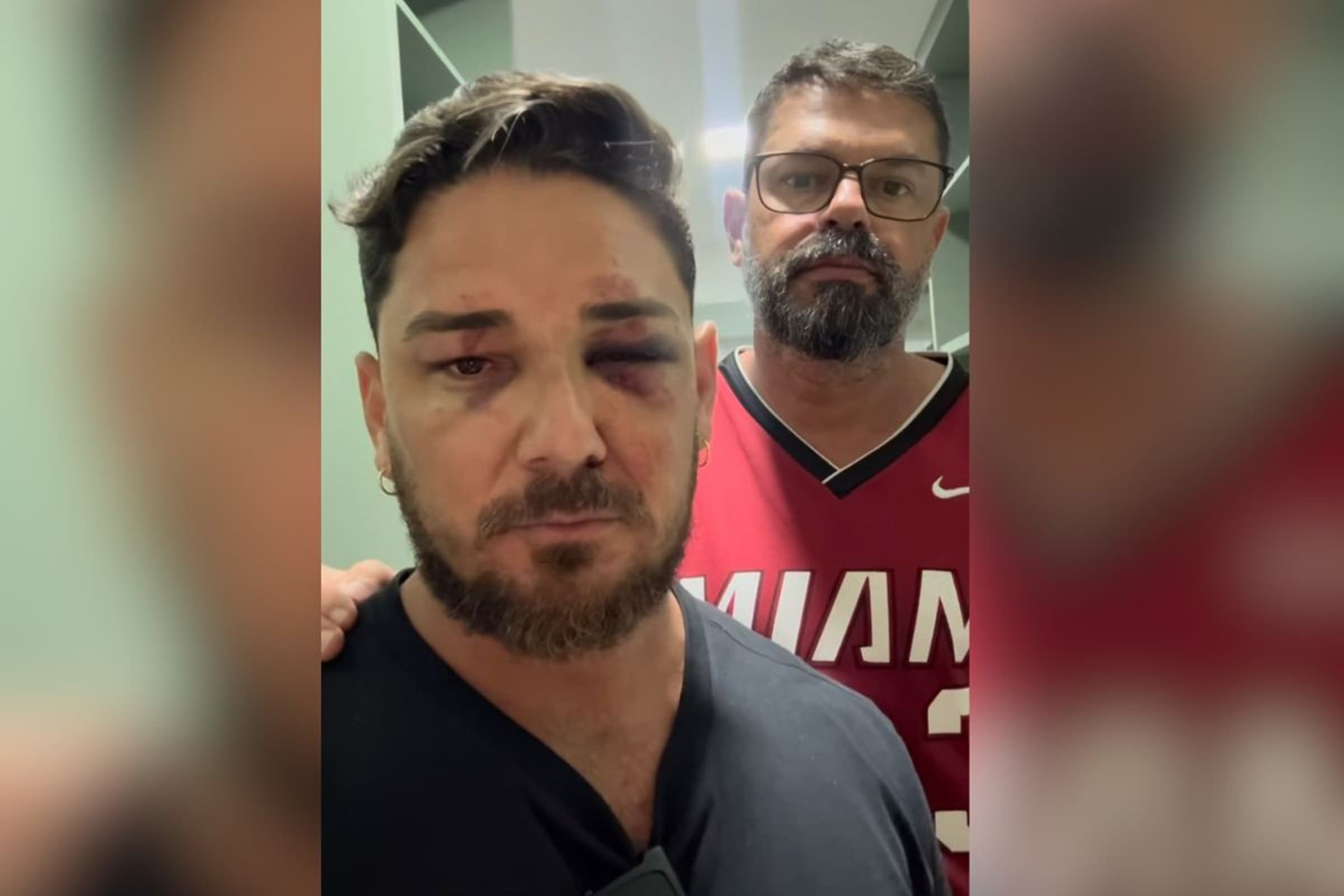 Casal agredido em Porto de Galinhas processa prefeitura e governo