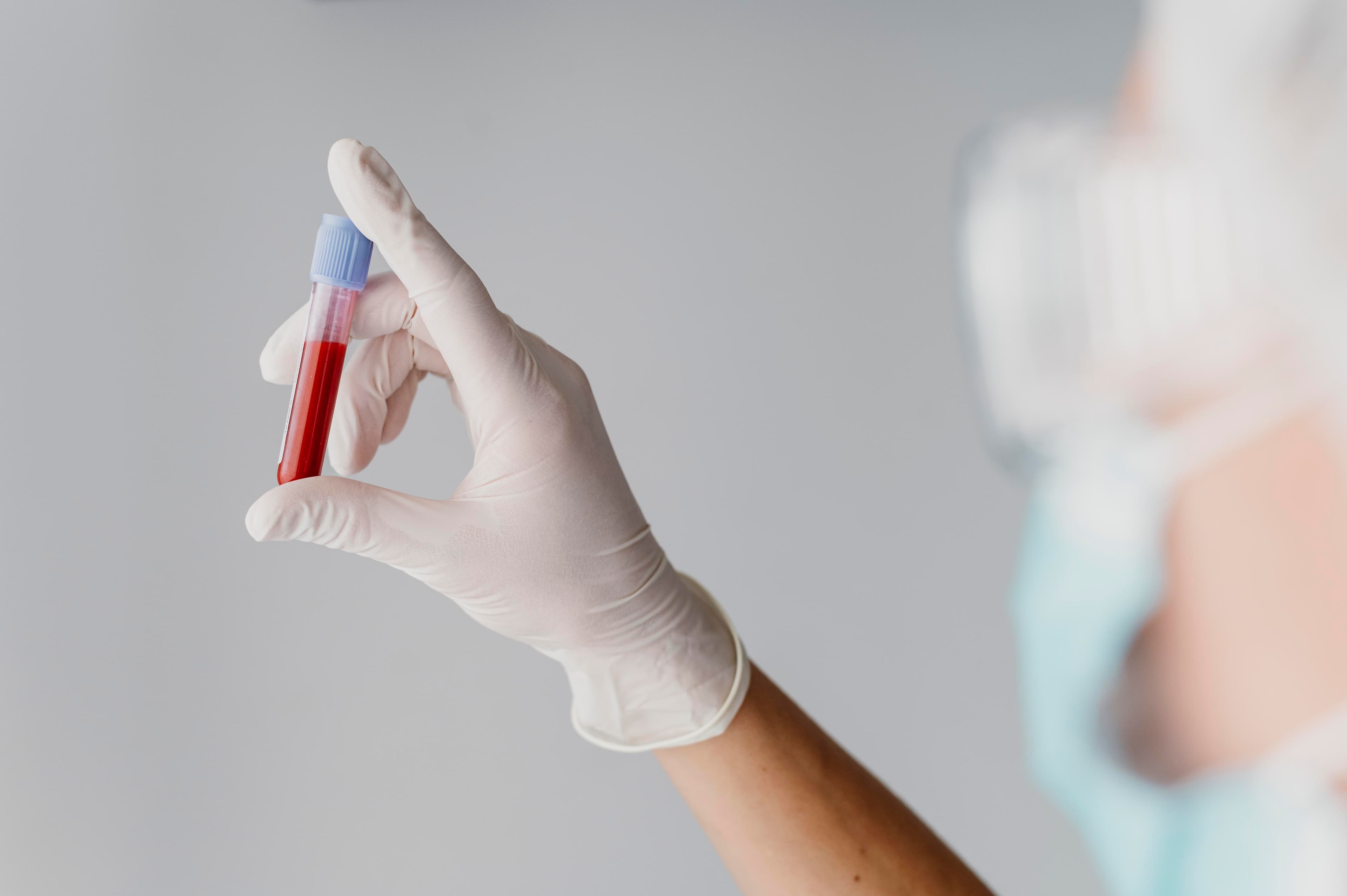 Exame de sangue simples pode prever expectativa de vida em idosos