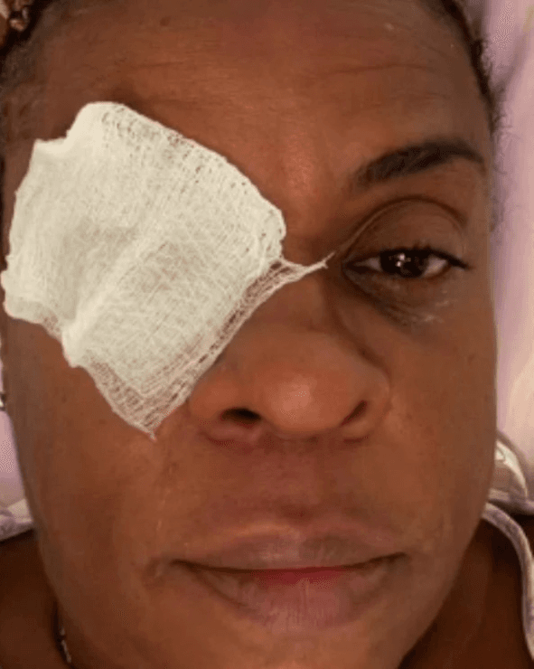 Atriz Cacau Protásio perde visão temporariamente após usar pomada capilar